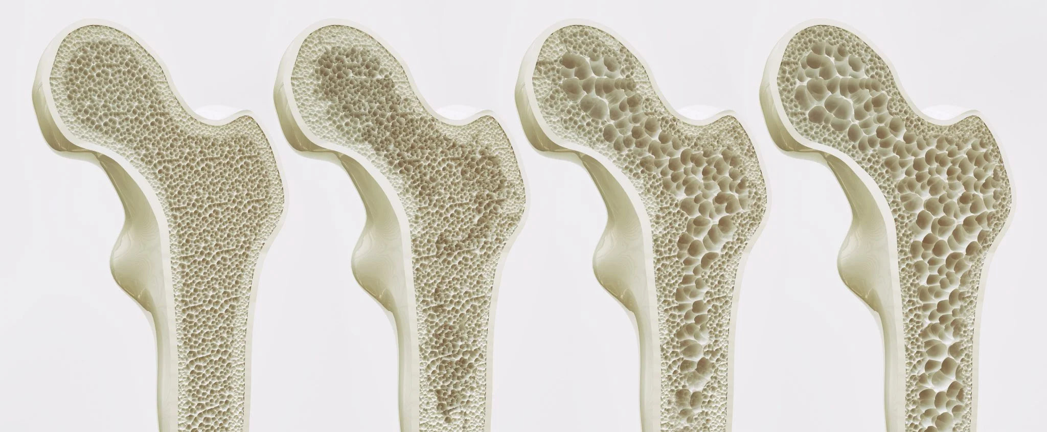 How Pura Collagen Can Support Bone Health